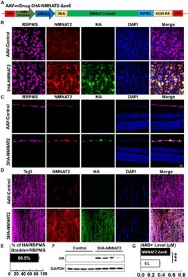 Neuronal NMNAT2 Overexpression Does Not Achieve Significant Neuroprotection in Experimental Autoimmune Encephalomyelitis/Optic Neuritis